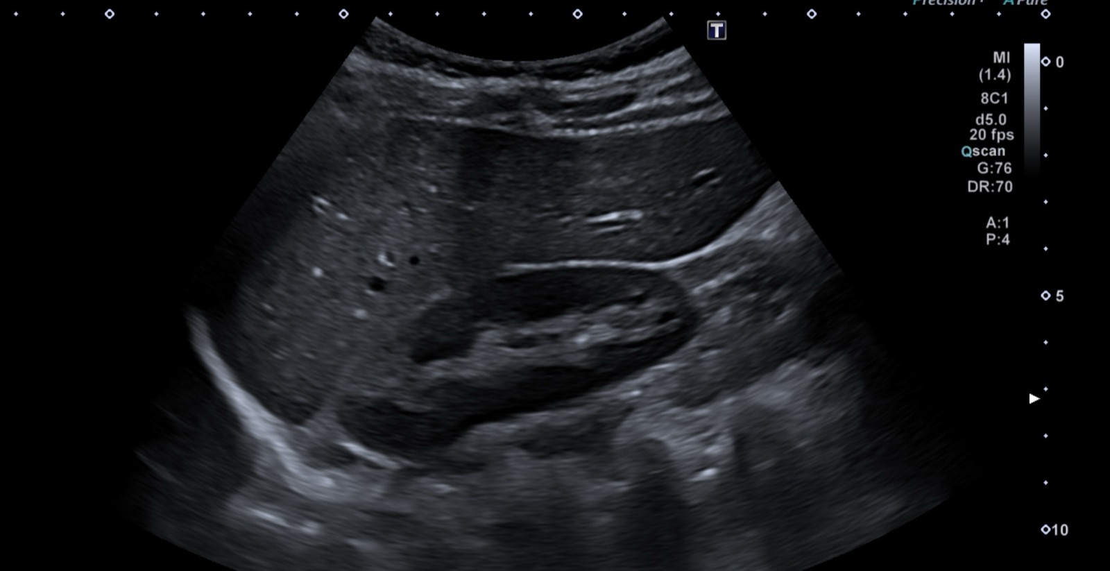 Échographie abdominale – IMCSM