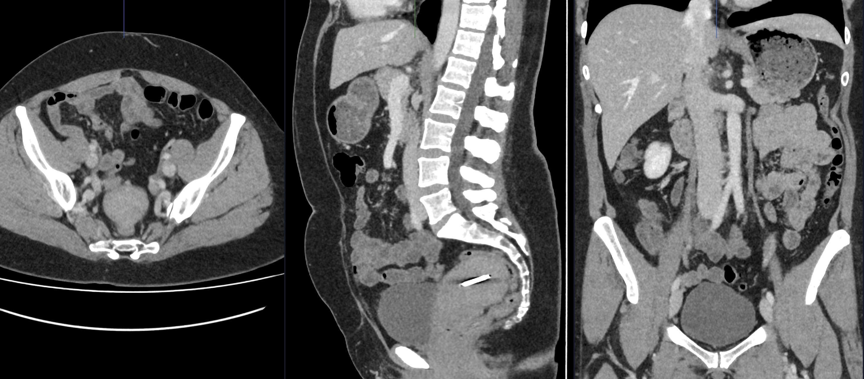 Scanner abdominal – IMCSM